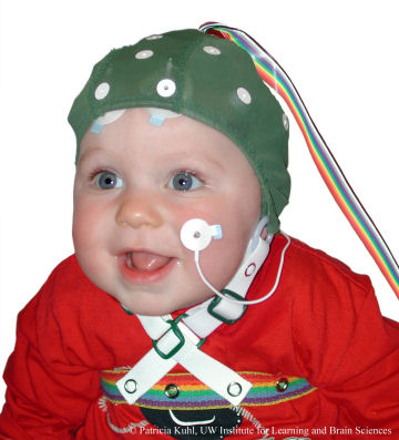 This baby is wearing an electrode cap―which painlessly monitors electrical activity in the brain during experiments.